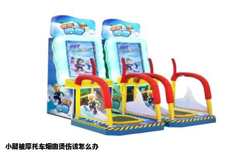 小腿被摩托车烟囱烫伤该怎么办